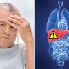 bệnh viêm gan b có nguy hiểm không